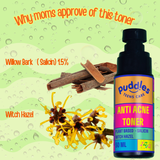 Puddles Anti-Acne Toner for Acne-Prone Skin | Sulphate & Fragrance Free